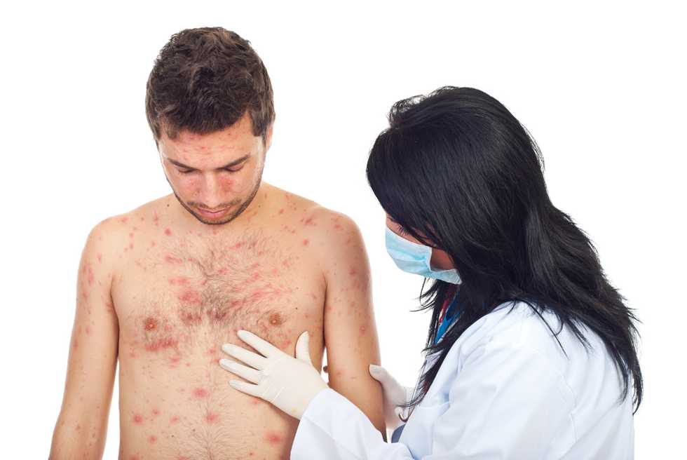 Kansas man's death leads CDC officials to discover scary new disease