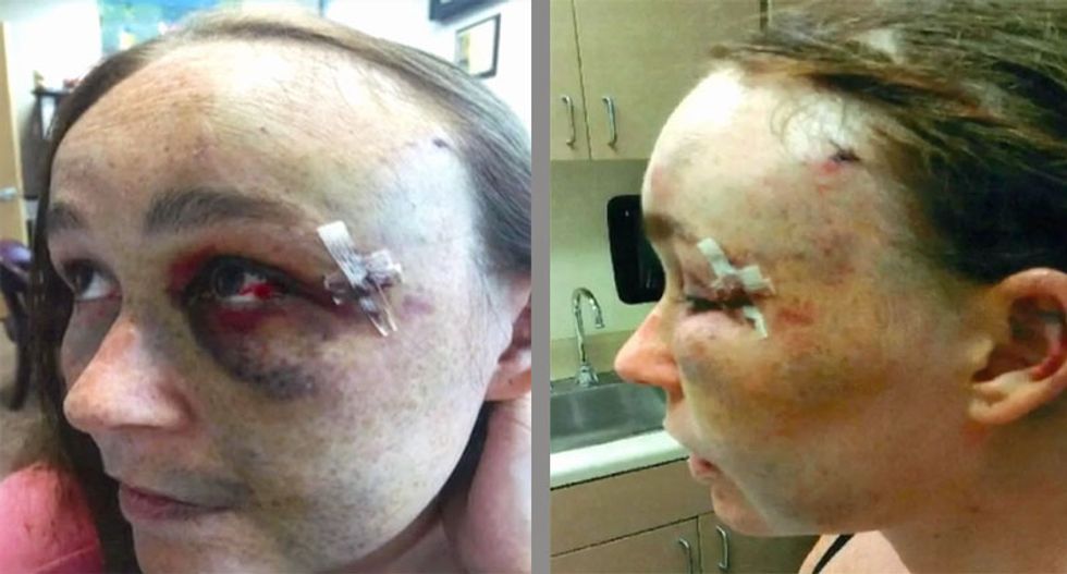 WATCH: Fort Lauderdale cops beat woman just 8 days after she testified against police brutality
