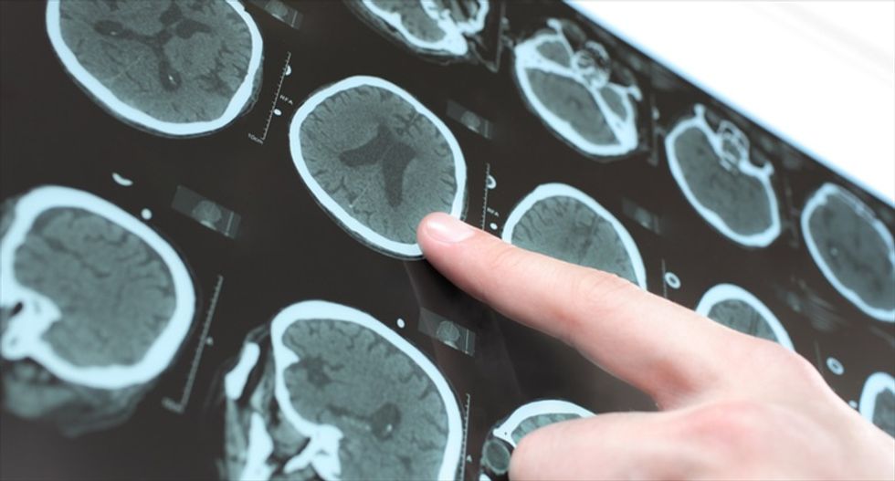 People with OCD know what to do — they just have trouble doing it