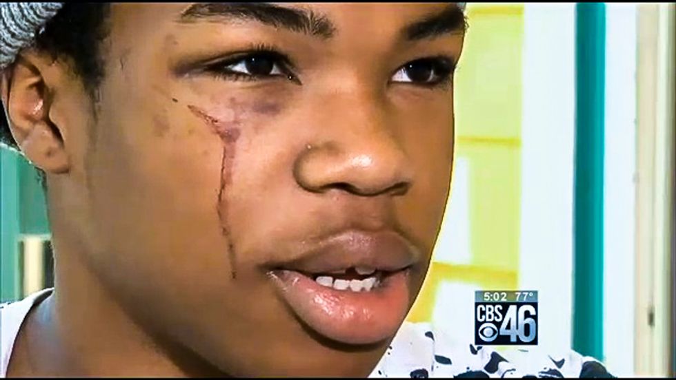 Gay student has screwdriver jabbed in face during '5-round' brawl as principal watches without helping
