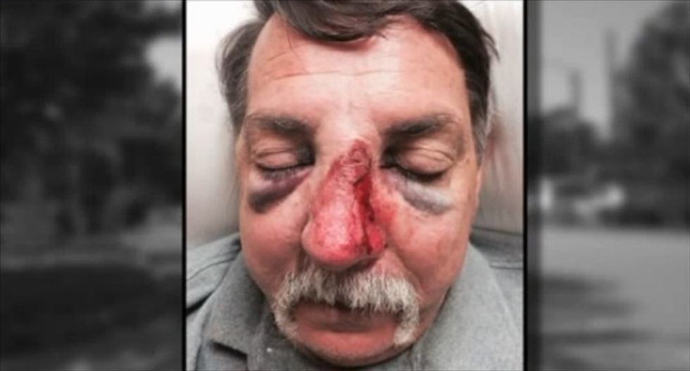 Federal marshal investigated after hitting man with his gun in road rage incident
