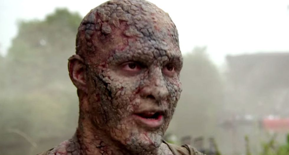 Greyscale in Game of Thrones and the biblical mistranslation of leprosy