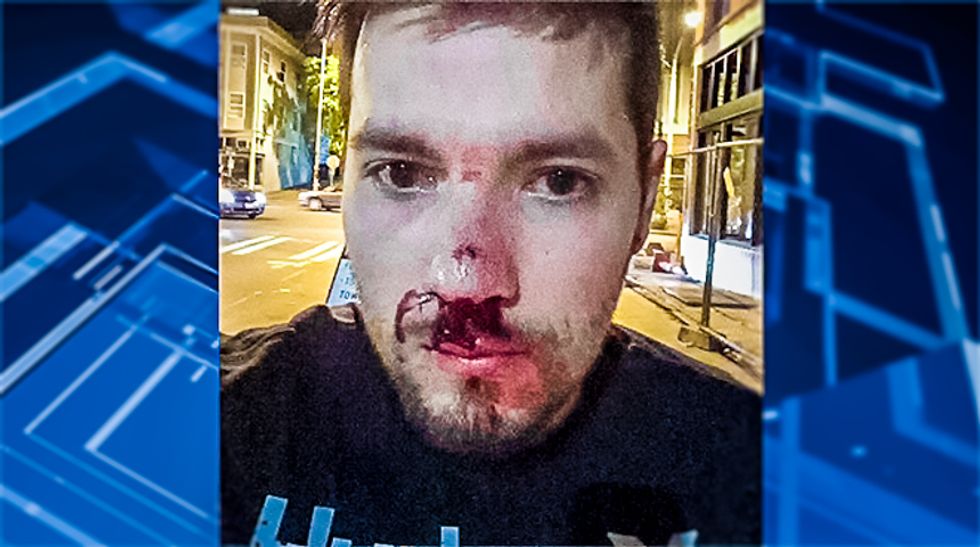 Gay couple beaten by homophobes at Seattle Pride celebration faces thousands in medical bills