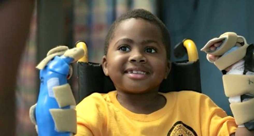 First child double hand transplant announced in US