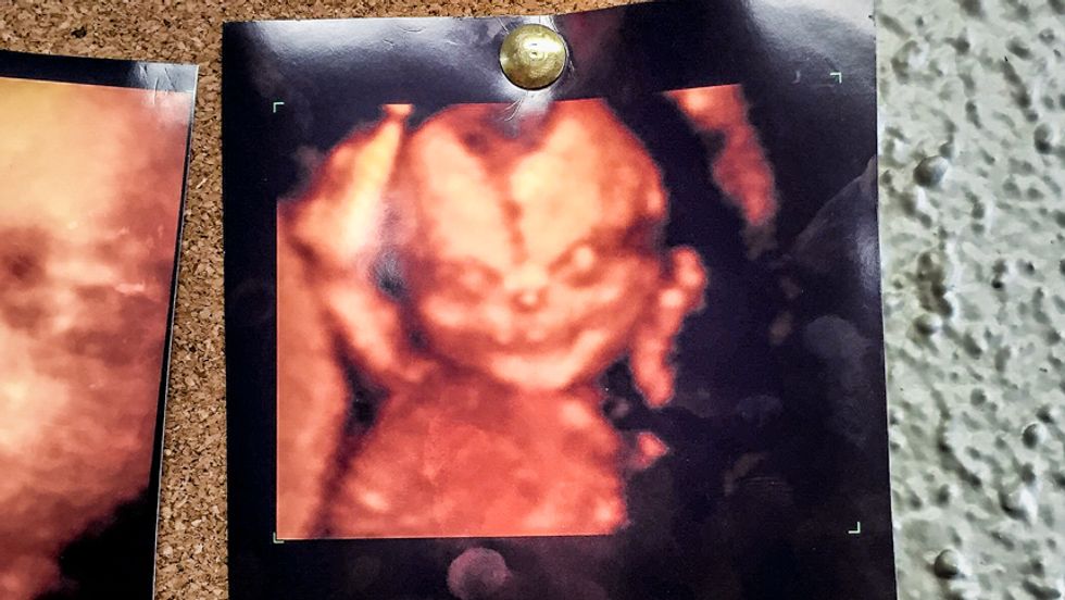 Pregnant couple freaks out at doctor after seeing 'demon' in ultrasound image