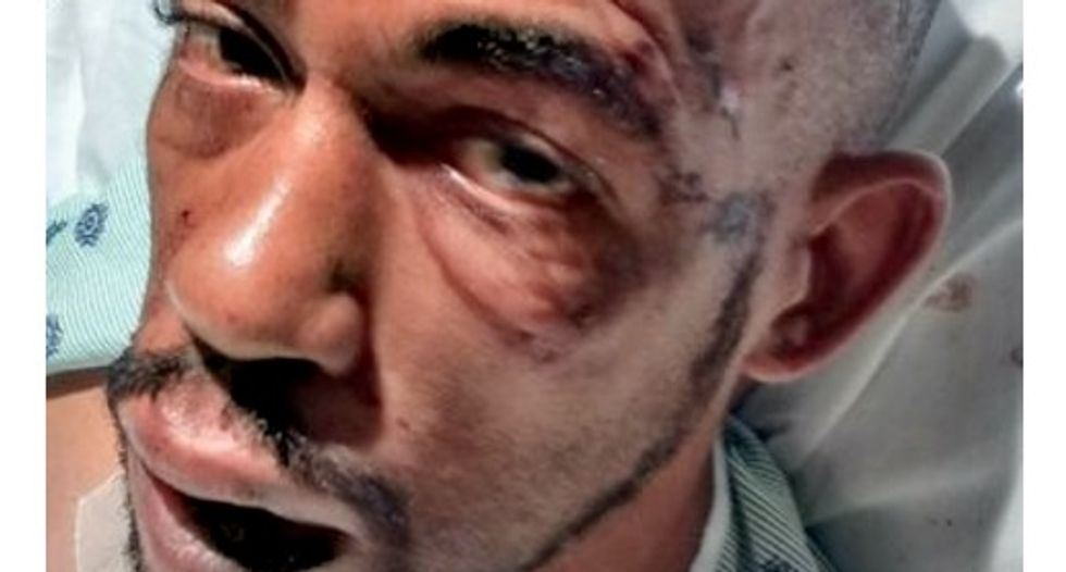 Epileptic man claims cops assaulted him when he had a seizure, body cam proves it