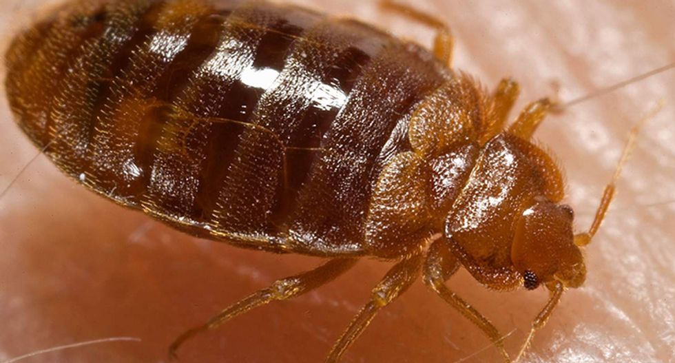 Customer sues Trump National resort after bedbug-infested room leaves his body covered in sores
