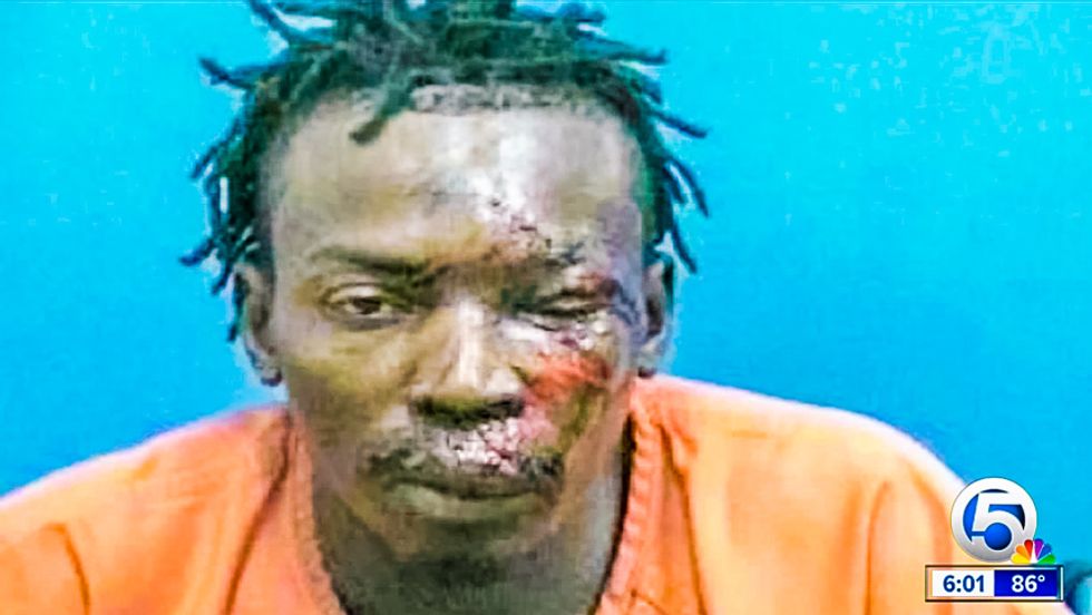 Florida sheriff: 'Absolutely no evidence' man in bloody mug shot was beaten by deputy