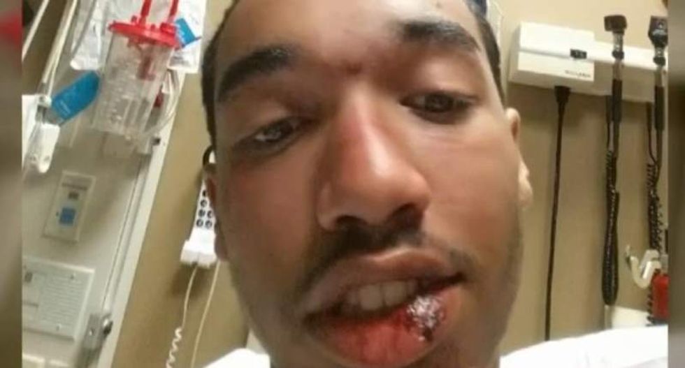 Autistic, legally-blind Minnesota teen suffers seizures after cops slam him to the ground