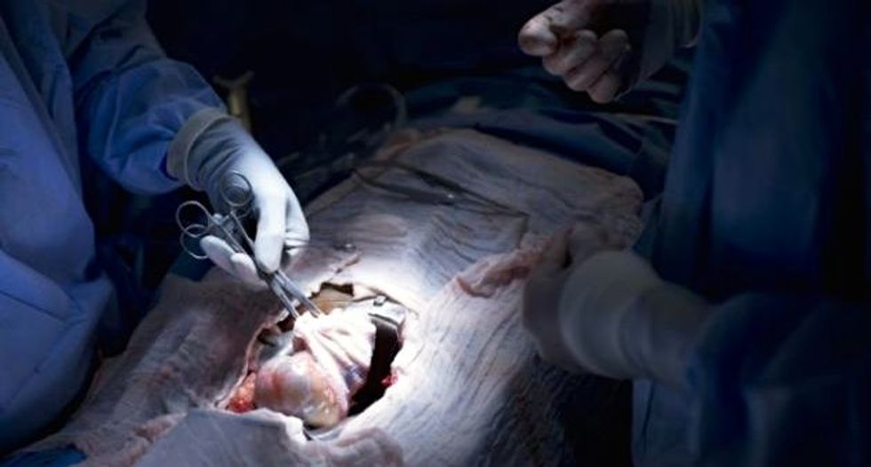 In boost for transplants, kidney tissue grown in lab