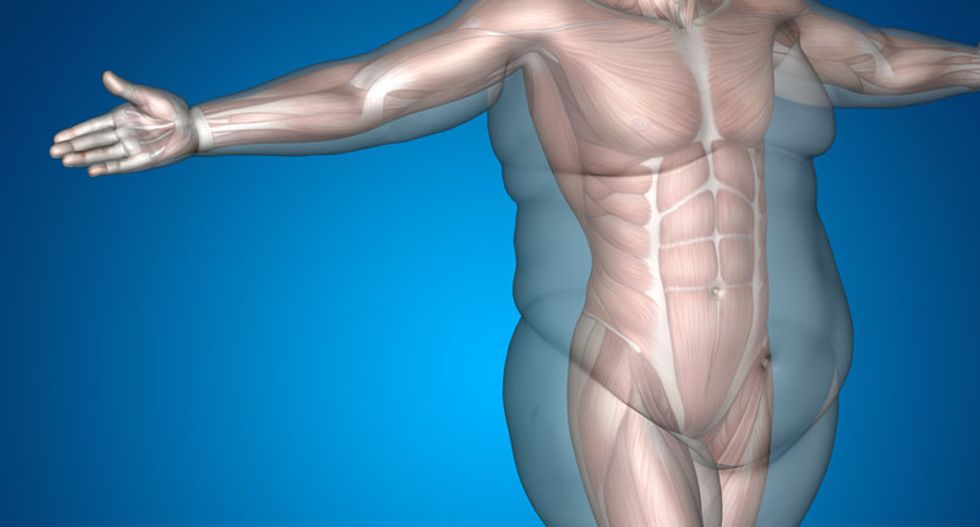 'Fit but fat' advice for obese people is not only unhelpful but also not true