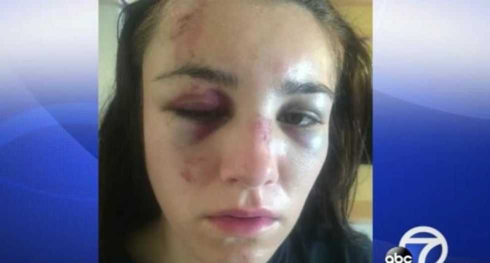 Calif. teen sues cop who threw her face-first to the ground hours after she graduated high school