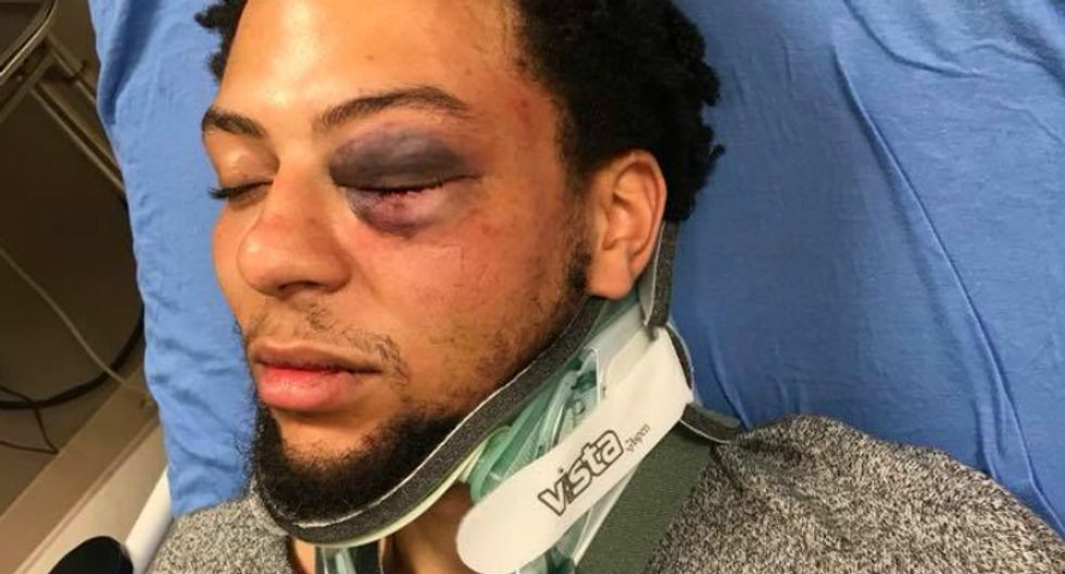Black Navy vet says white bouncers broke his ribs and called him a 'n*gger' in brutal Cinco de Mayo attack