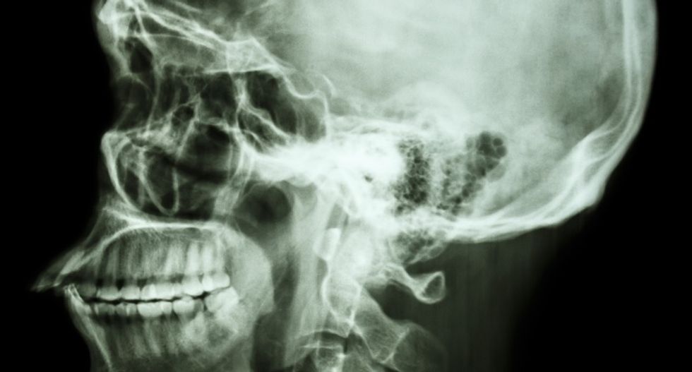 Millions of Americans’ medical images and data are available on the Internet -- and anyone can take a peek