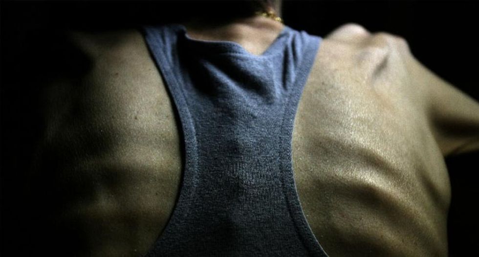 Surprise: Not shaming people about weight helps combat both anorexia and obesity