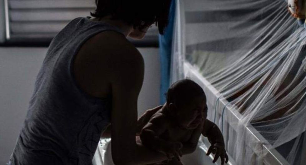 Researchers find Zika virus in microcephalic Brazilian babies' brains