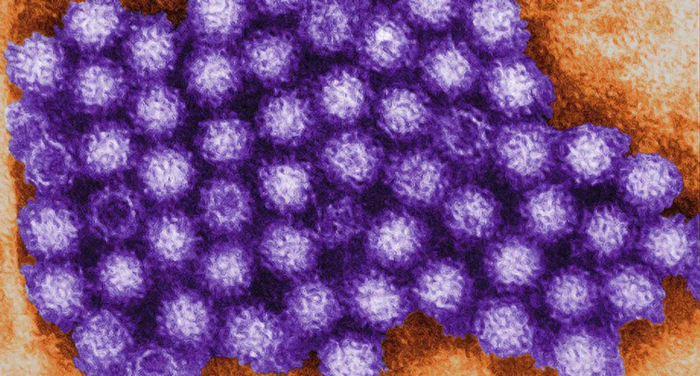 California Republican staffers in Ohio develop Norovirus symptoms