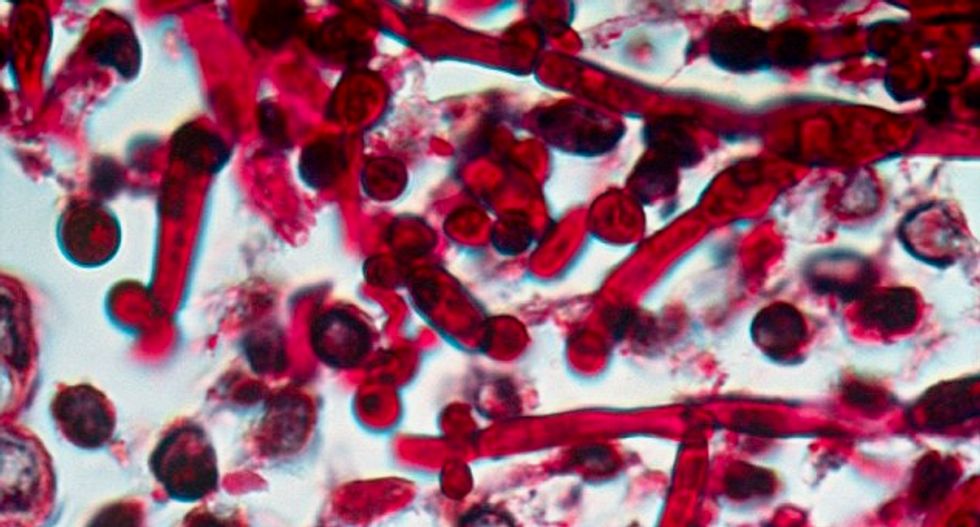 Bacterial sex: the promiscuous process driving antibiotic resistance
