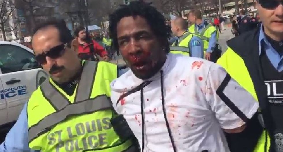 Police seek arrest of yet another Trump supporter for bloody, violent assault on black activist