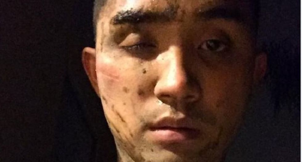 Gay man beaten by slur-yelling attackers in LGBT-friendly West Hollywood