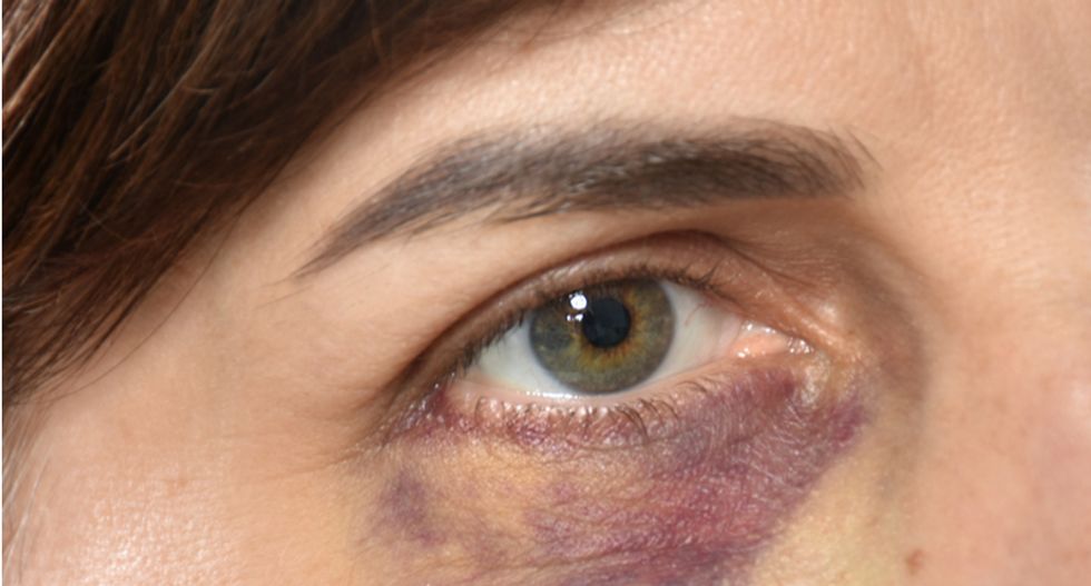 Indiana police searching for three who taunted woman for dating a black man -- then beat her when she came out of her home