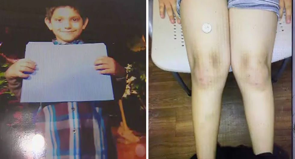 Texas police used handcuffs, batons and a Taser to subdue 7-year-old special needs boy, family says