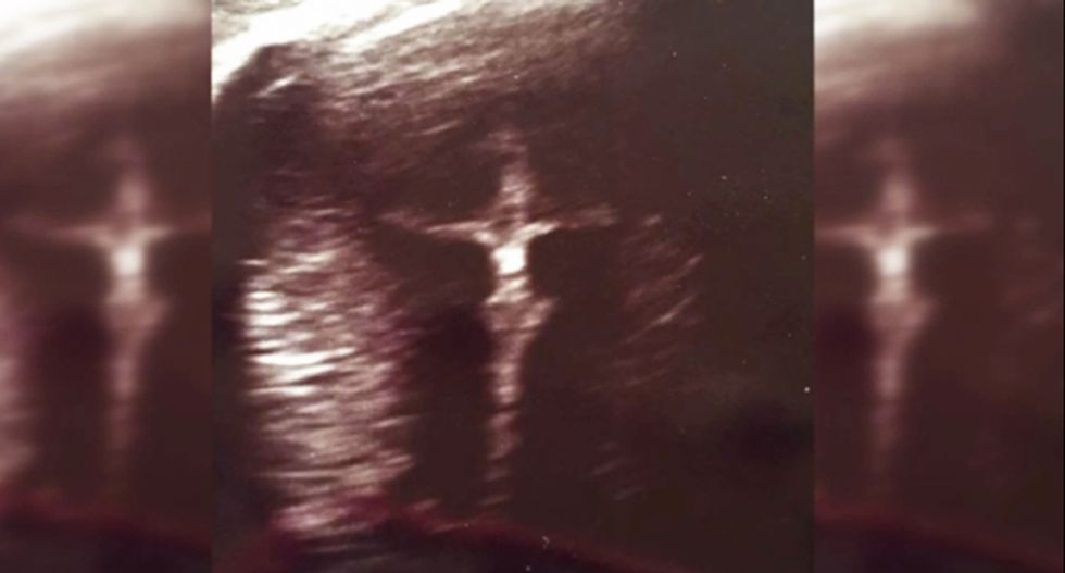 Indiana woman claims ultrasound shows Christ on a cross: 'His legs are crossed and everything'
