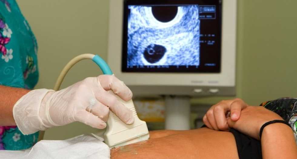 Kentucky moves toward requiring ultrasound before abortion