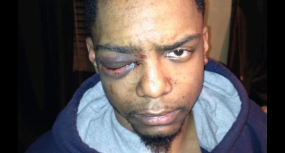 Gay man claims NYPD's 'special connection' to Hasidic safety patrol led to cover-up of his beating