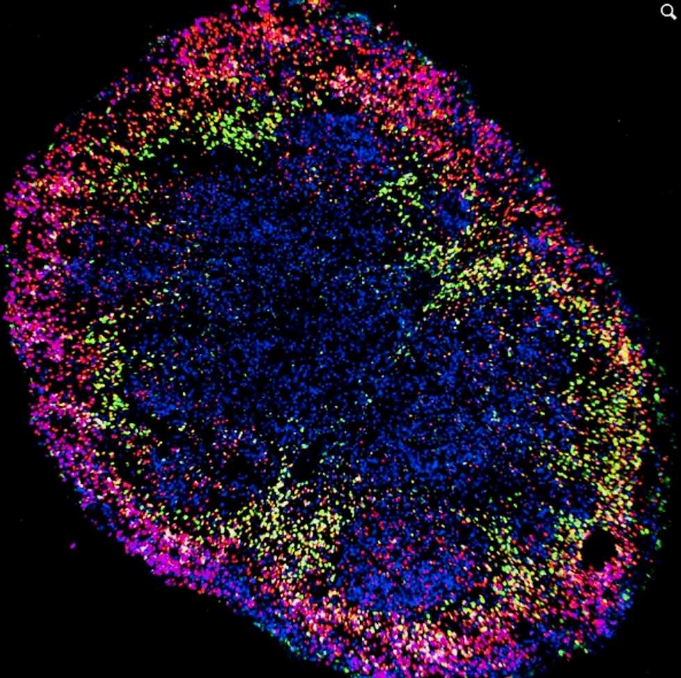 Brain organoids help neuroscientists understand brain development, but aren’t perfect matches for real brains