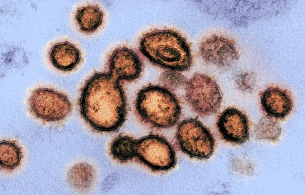 This simple graphic perfectly explains how the coronavirus works on your body