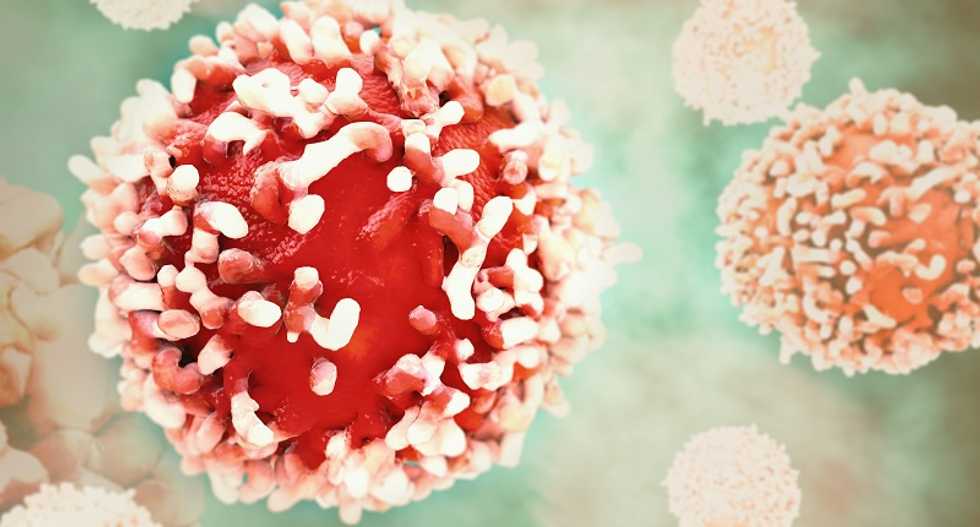 Cancer deaths decline in US, with advances in prevention, detection and treatment