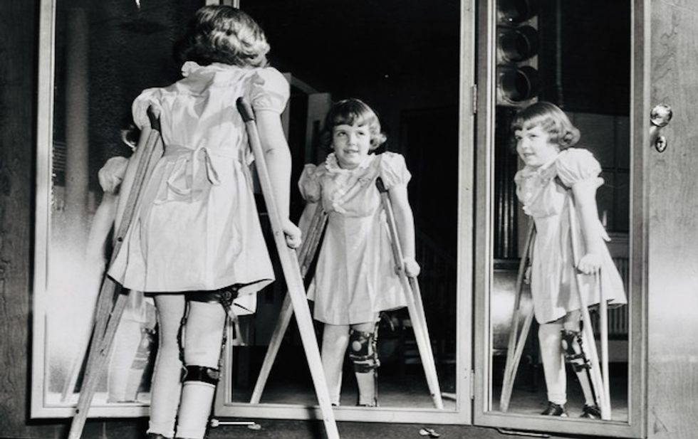Polio: a mysterious epidemic caused enormous fear in the 20th century, but medicine beat it with a vaccine