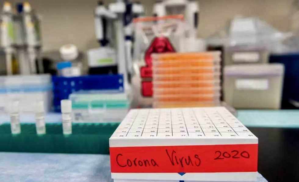 Oxford University pushing science to the limit in vaccine hunt