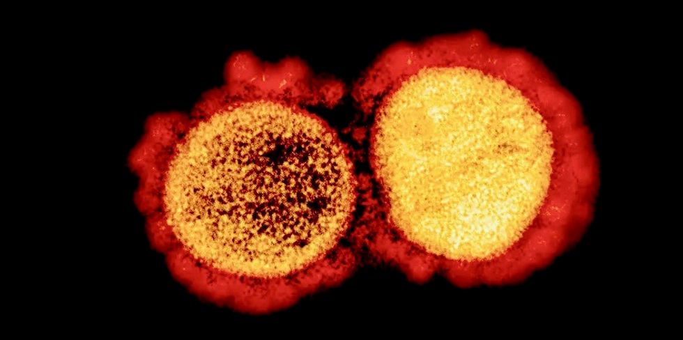 Eli Lilly applies for emergency approval for COVID-19 antibodies