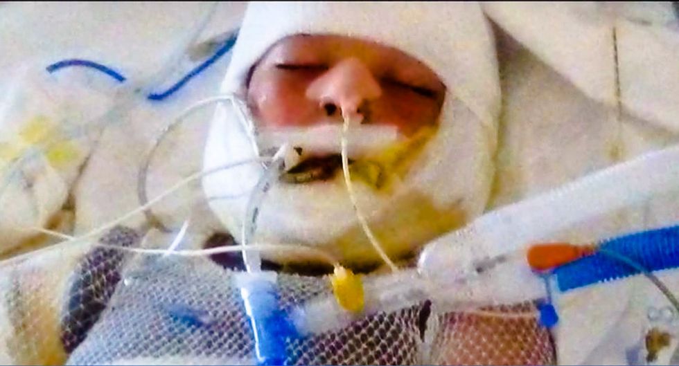 10-year-old special needs child in coma after being doused with gas and set on fire by bullies