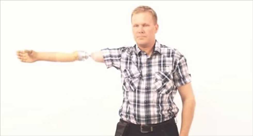 WATCH: Prosthetics innovations help patients regain arm control and sense of touch