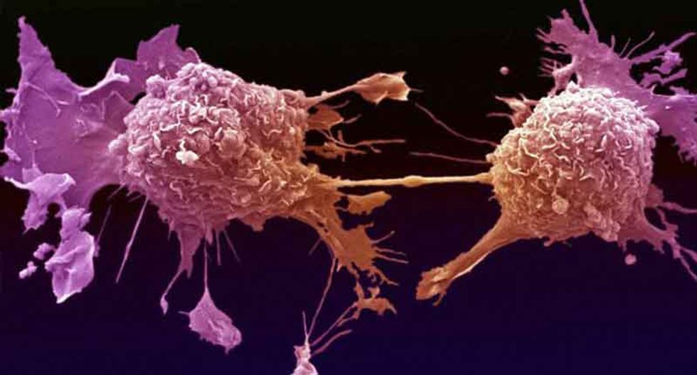 Americans overpaying hugely for cancer drugs - academic study