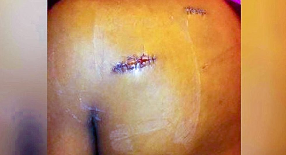 'I'm not a bad person': Transgender woman survives hatchet attack in North Carolina park
