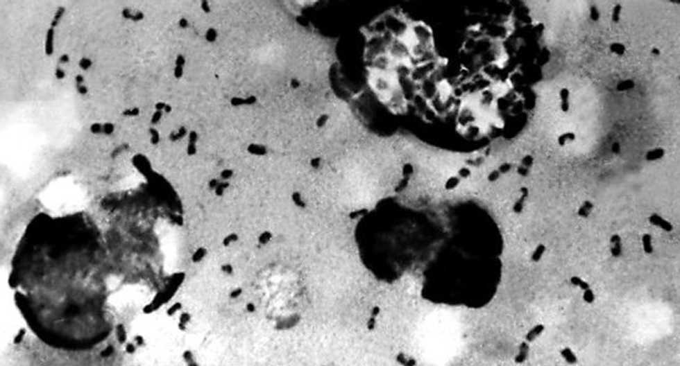 Bubonic plague outbreak kills 40 in Madagascar: WHO