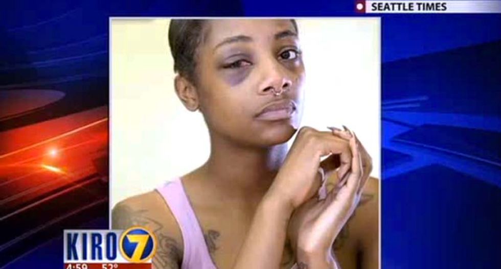 Seattle police officer who broke handcuffed woman's eye socket with punch not charged