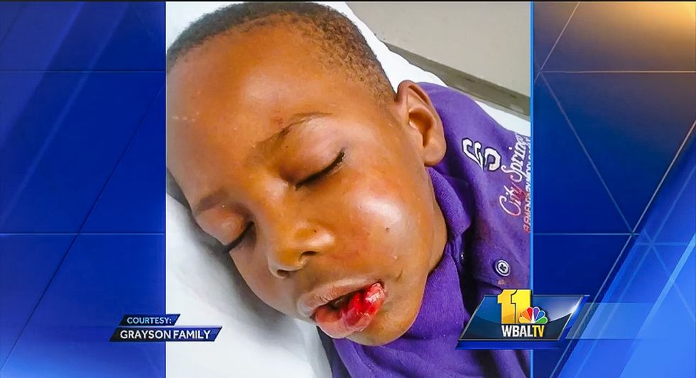 Baltimore teacher charged with child abuse for allegedly breaking jaw of 'disruptive' 7-year-old