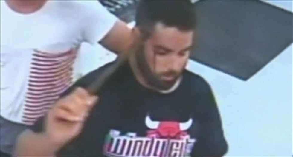 OUCH: Man calmly seeks help after attacker impales him with metal rod