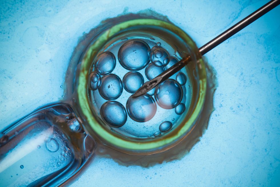 Why DNA ancestry tests are misleading at best — and sinister at worst