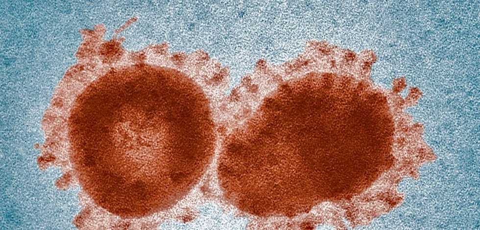 Maybe coronavirus’s aggressiveness could be changed by adding or subtracting sugar molecules from its spike protein