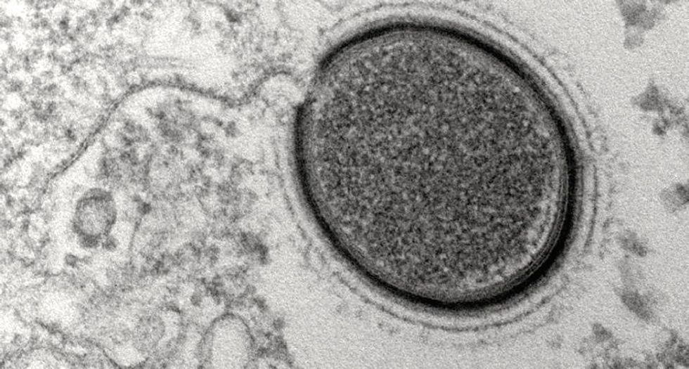 Siberian 'soft virus' could be just one ancient pathogen revived by climate change
