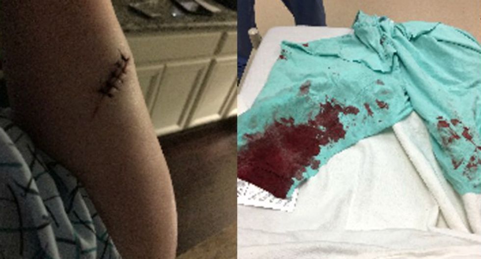 White man stabs a Muslim nurse and calls her a 'sand n**ger' during hate-filled attack in Houston