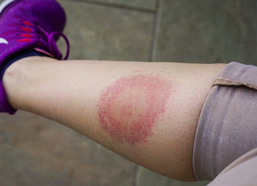 The US has a history of testing biological weapons on the public – were infected ticks used too?