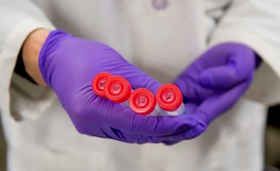 Japan approves growing human organs in animals for first time