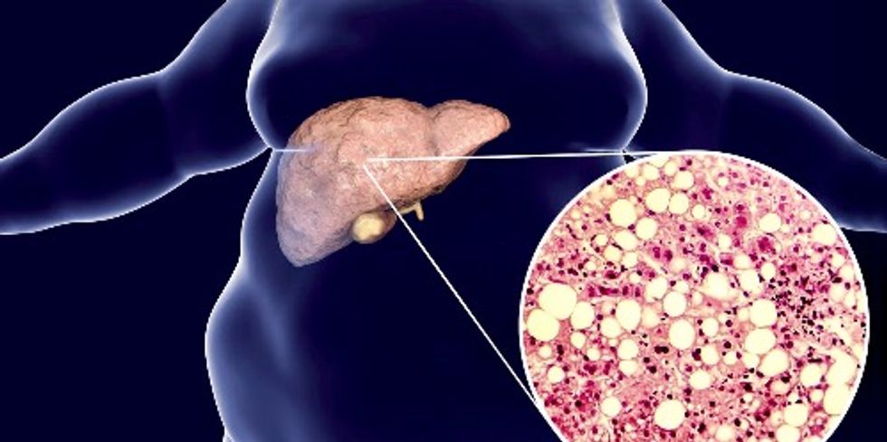 How to grow human mini-livers in the lab to help solve liver disease